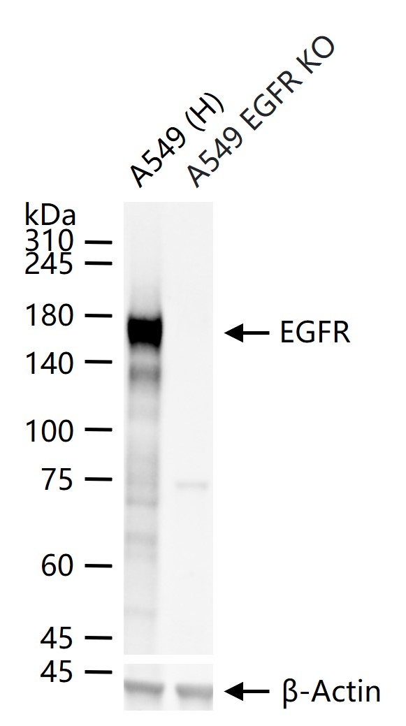 表皮生长因子受体重组兔单抗
