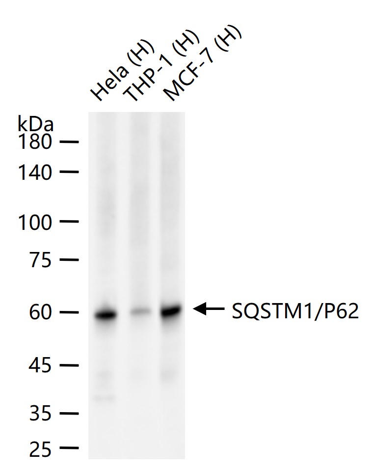 泛素结合蛋白P62重组兔单抗