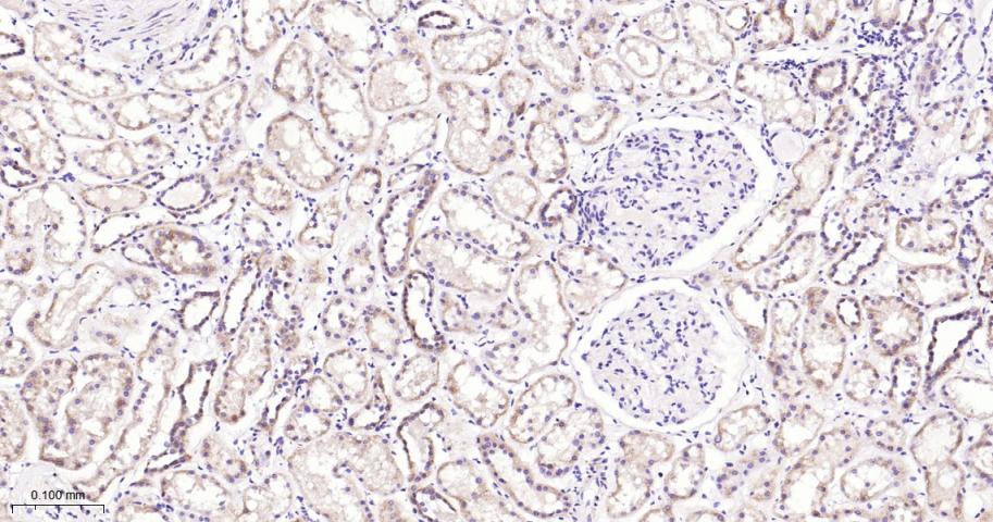 肿瘤坏死因子受体相关因子2重组兔单抗