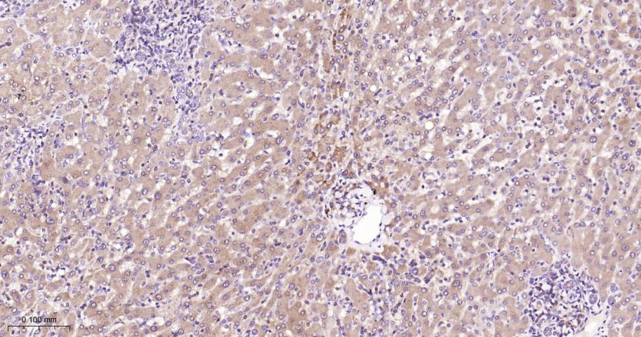 肿瘤坏死因子受体相关因子2重组兔单抗