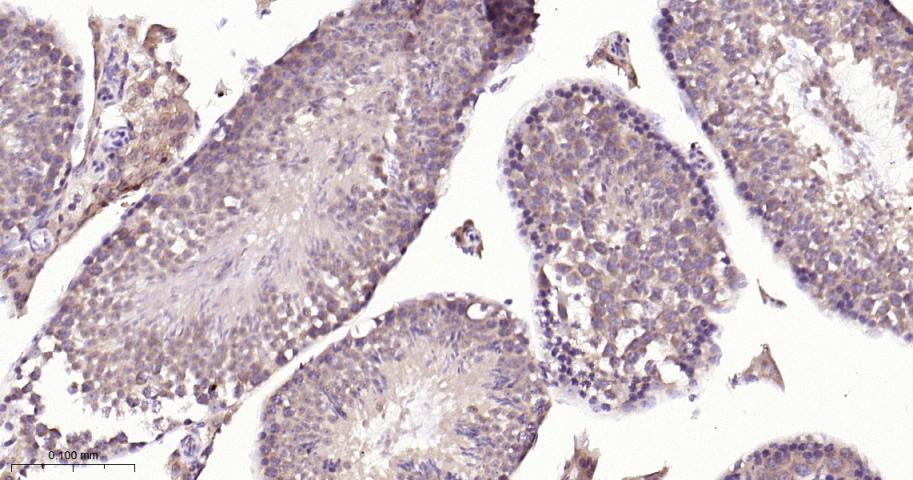 肿瘤坏死因子受体相关因子2重组兔单抗