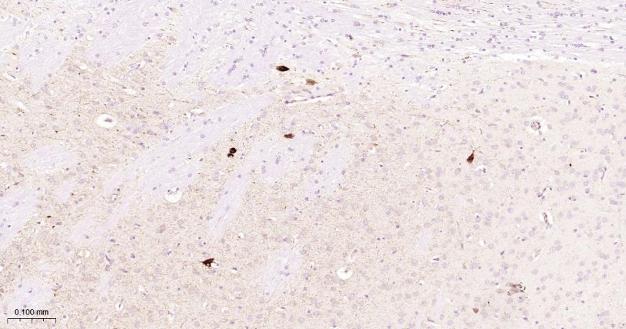 ChAT胆碱乙酰转移酶重组兔单抗