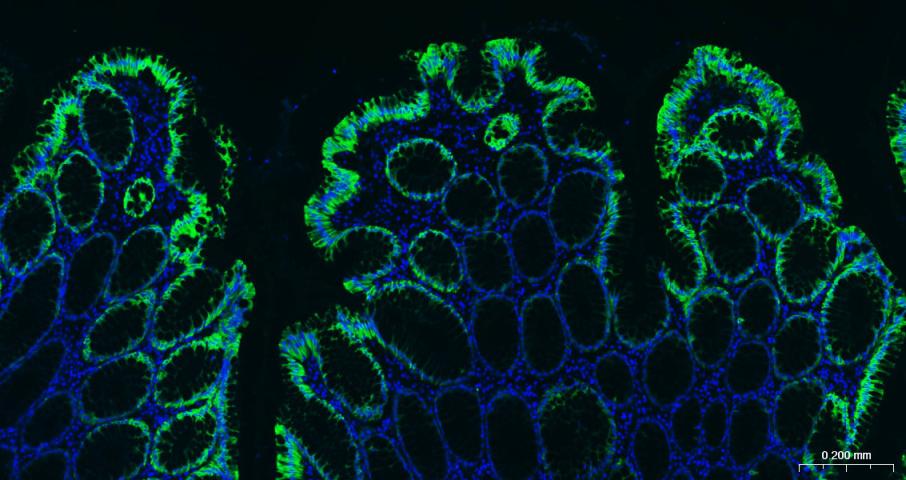 细胞角蛋白20抗体-bsm-34154M