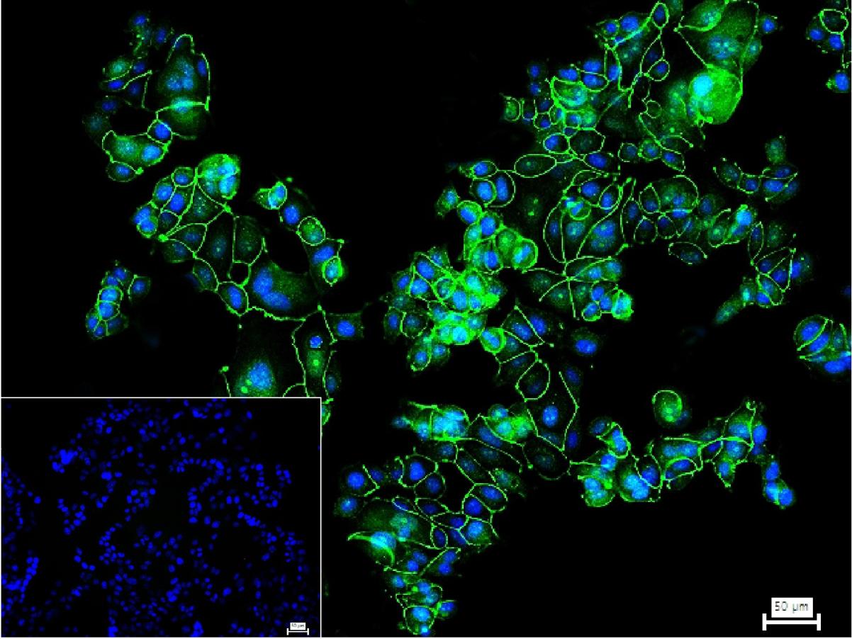 胞质紧密粘连蛋白1/闭锁小带蛋白1抗体-bs-1329R