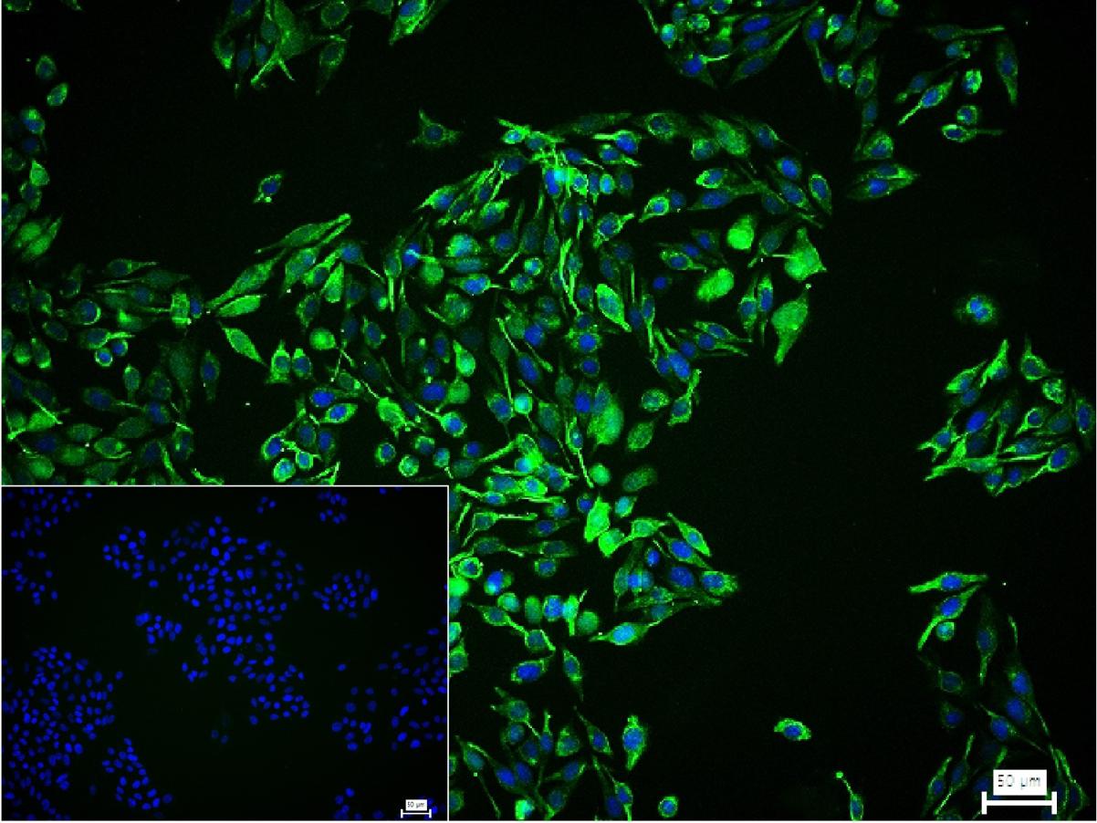 S100B蛋白重组兔单抗