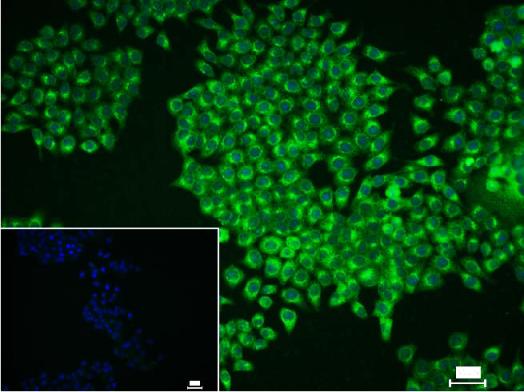核糖体S6蛋白激酶重组兔单抗