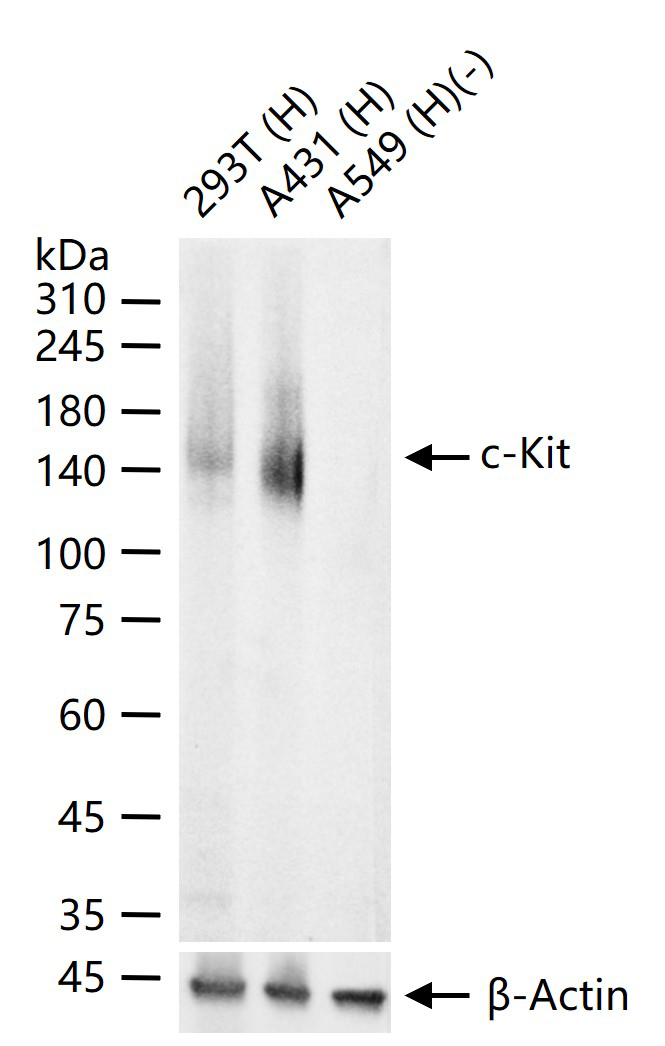 原癌基因蛋白c-kit(CD117)重组兔单抗