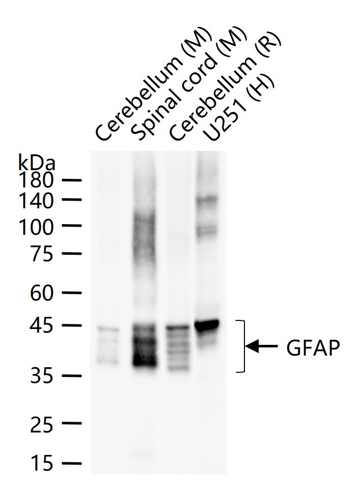 胶质纤维酸性蛋白重组兔单抗