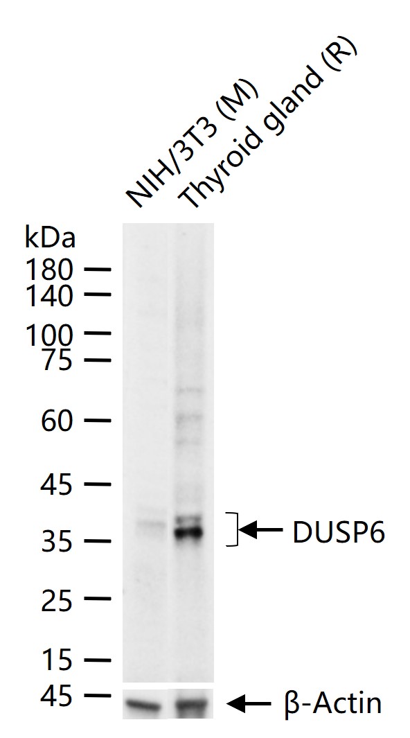 双特异性蛋白磷酸酶6重组兔单抗