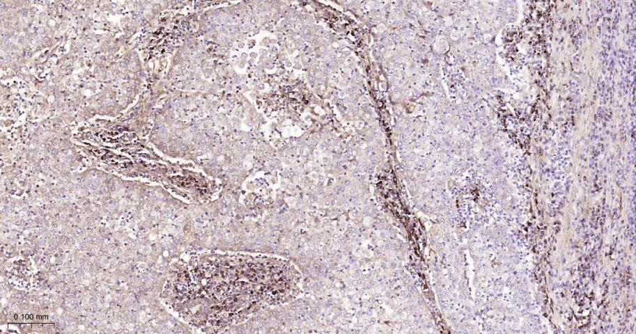 KB抑制蛋白激酶β重组兔单抗