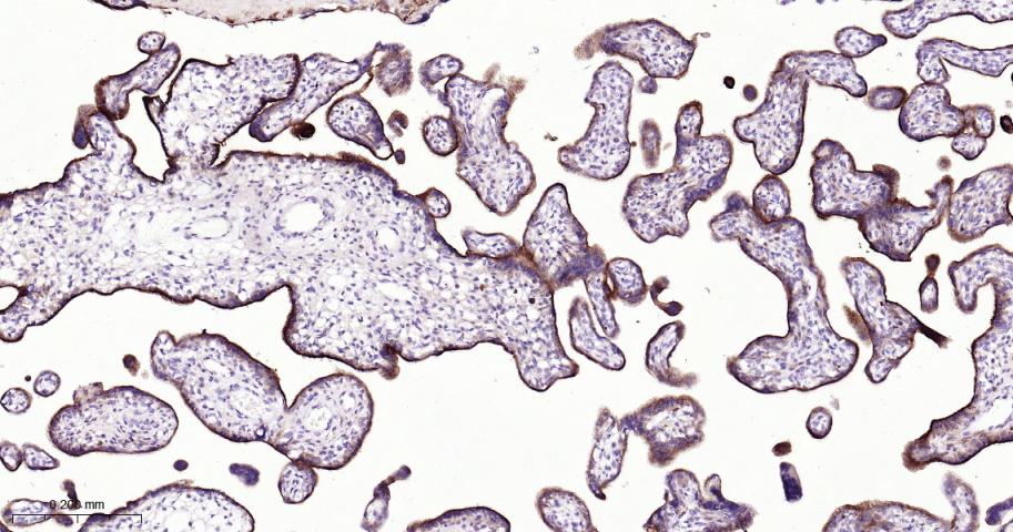转铁蛋白受体（CD71）抗体