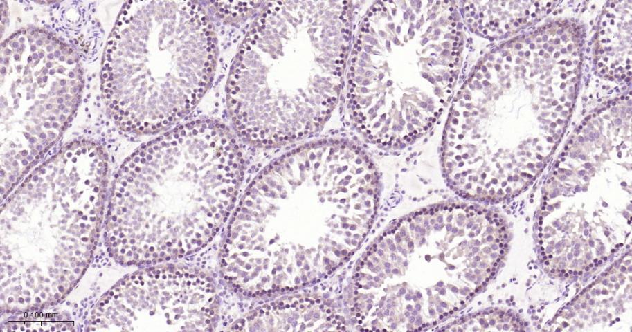 核糖体S6蛋白激酶重组兔单抗