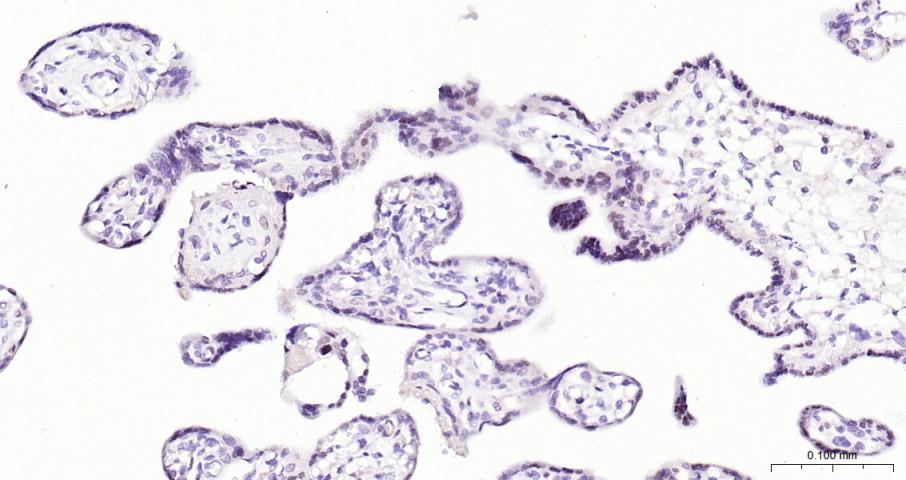 活化转录因子3抗体-bs-0519R