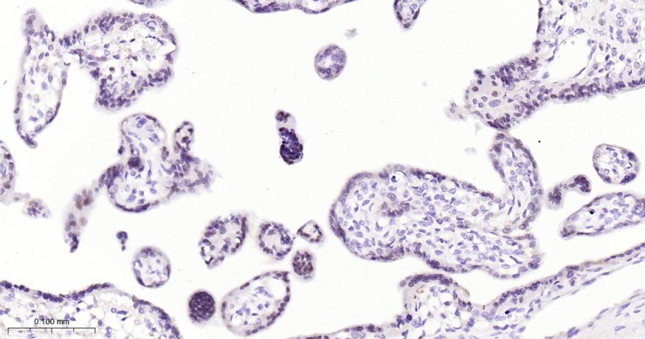 活化转录因子3重组兔单抗