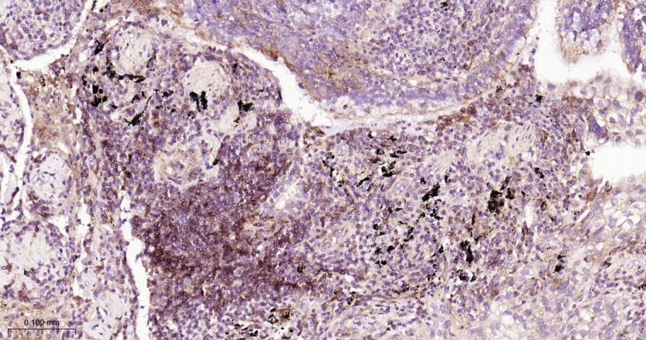 转铁蛋白受体（CD71）抗体