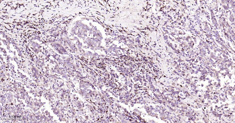 KB抑制蛋白激酶β重组兔单抗