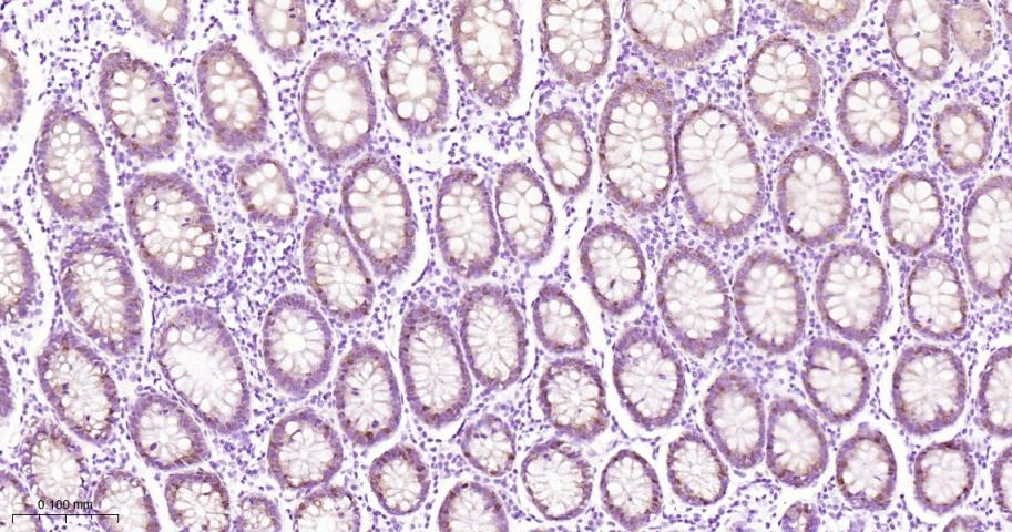 肠型脂肪酸结合蛋白重组兔单抗