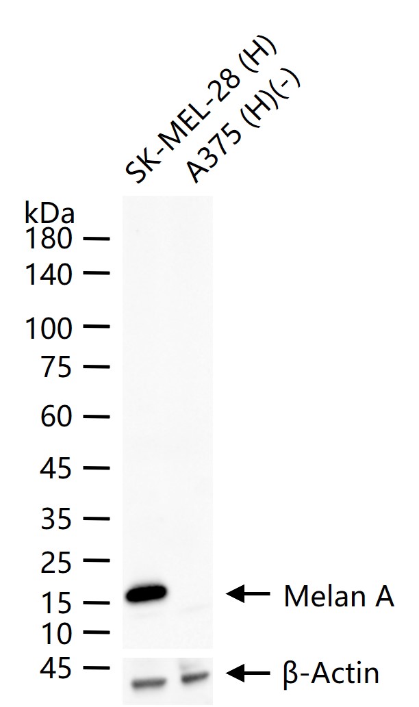 Melan A Rabbit pAb (一抗) - WB | Bioss
