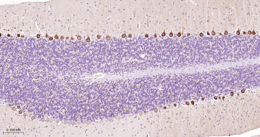 核糖体S6蛋白激酶重组兔单抗