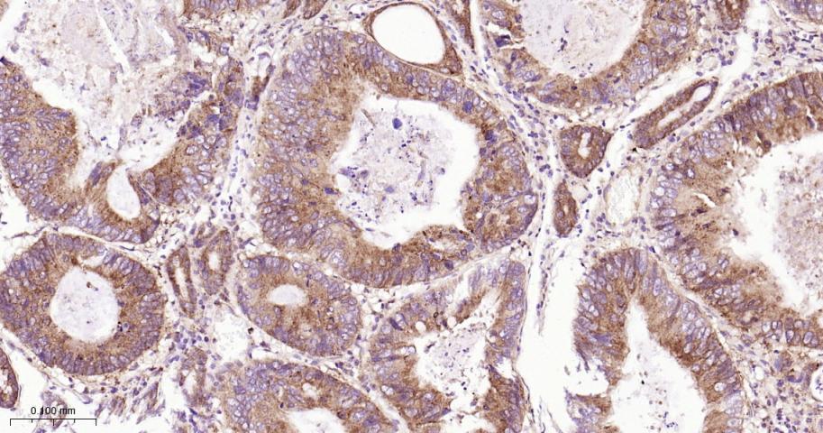 转铁蛋白受体（CD71）抗体