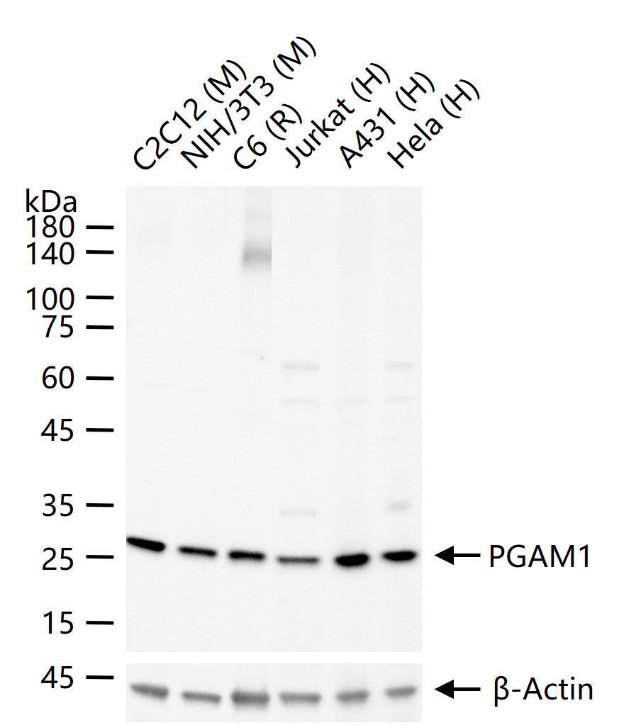 磷酸变位酶1重组兔单抗