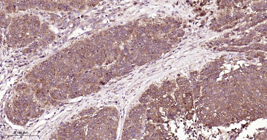 转铁蛋白受体（CD71）抗体