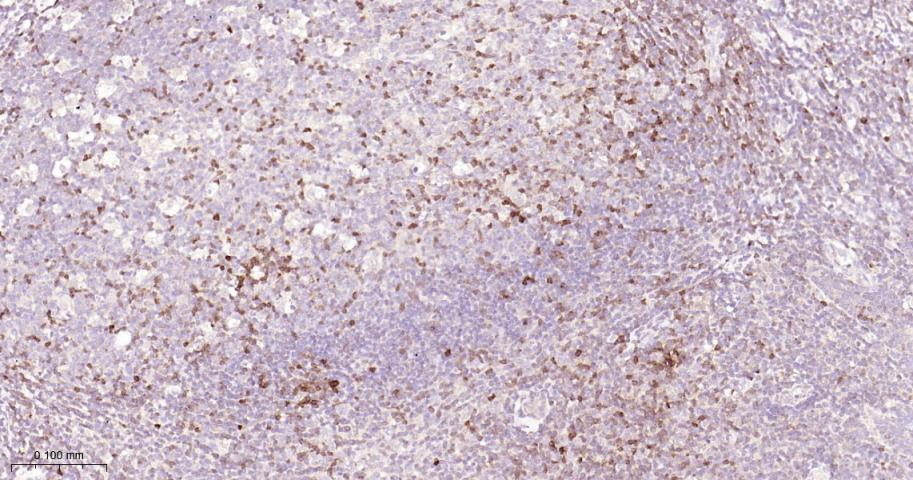 白介素8重组兔单抗