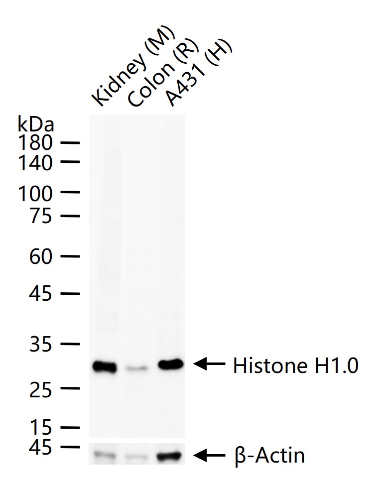组蛋白H1.0重组兔单抗