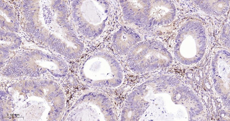 KB抑制蛋白激酶β重组兔单抗