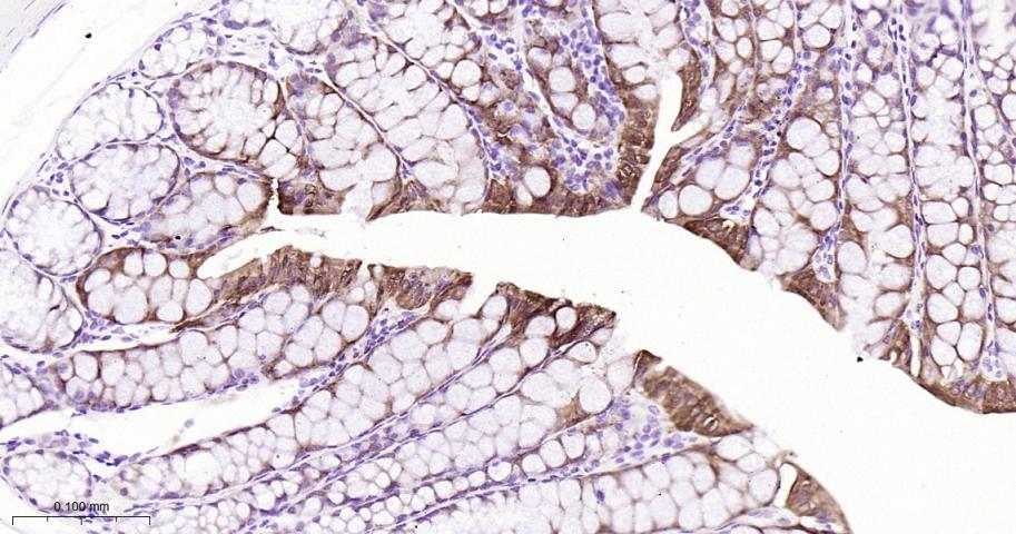 肠型脂肪酸结合蛋白重组兔单抗