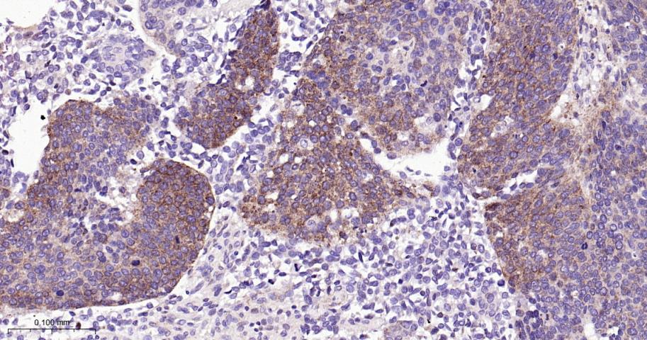 转铁蛋白受体（CD71）抗体