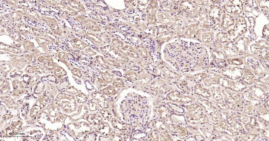 KB抑制蛋白激酶β重组兔单抗