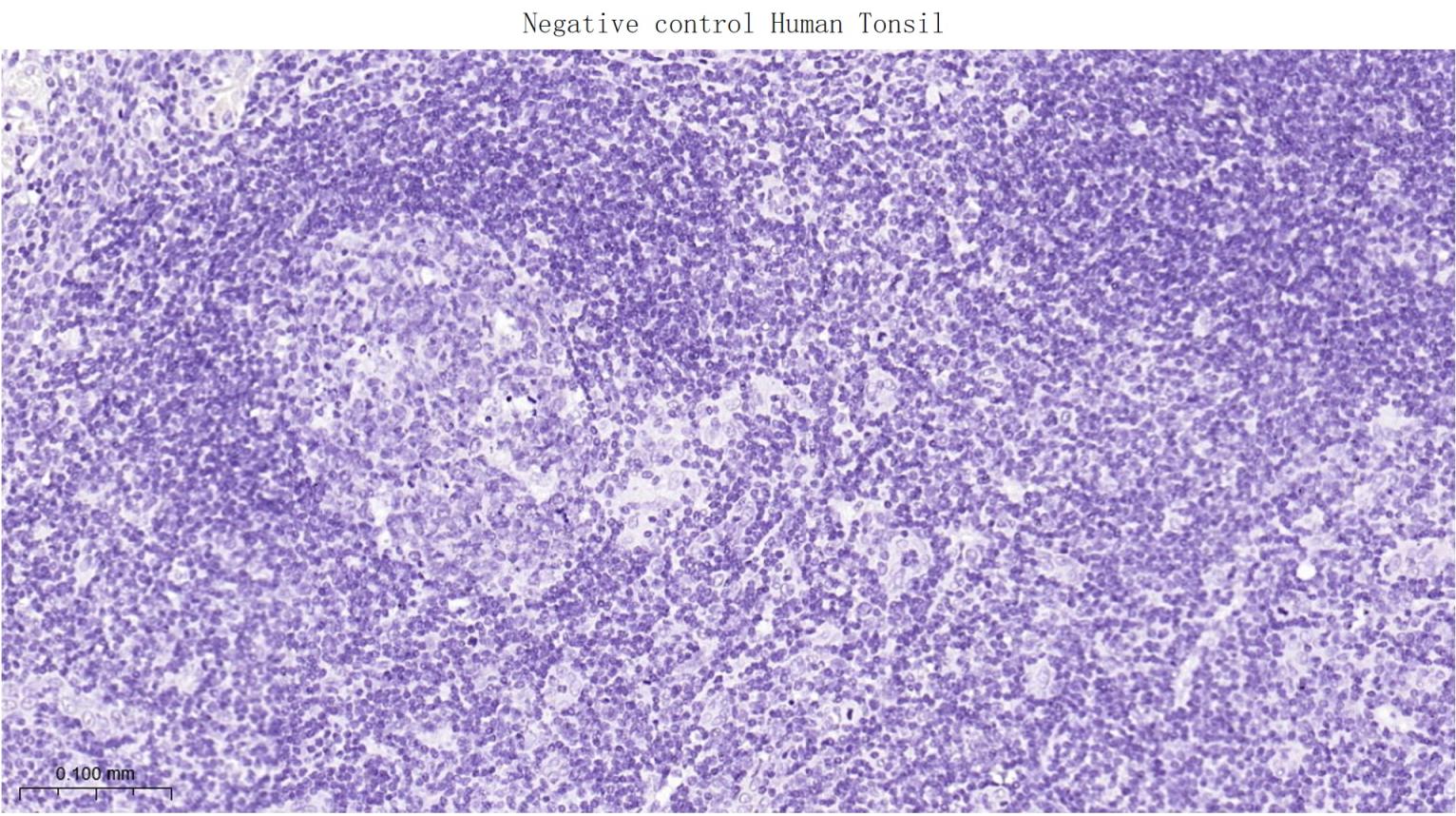 肠型脂肪酸结合蛋白重组兔单抗