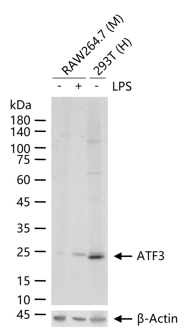 ATF3 Rabbit pAb (一抗) - WB,IHC-P,IHC-F,IF | Bioss