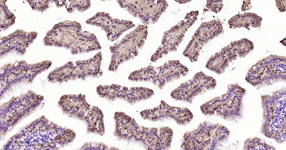 肠型脂肪酸结合蛋白重组兔单抗