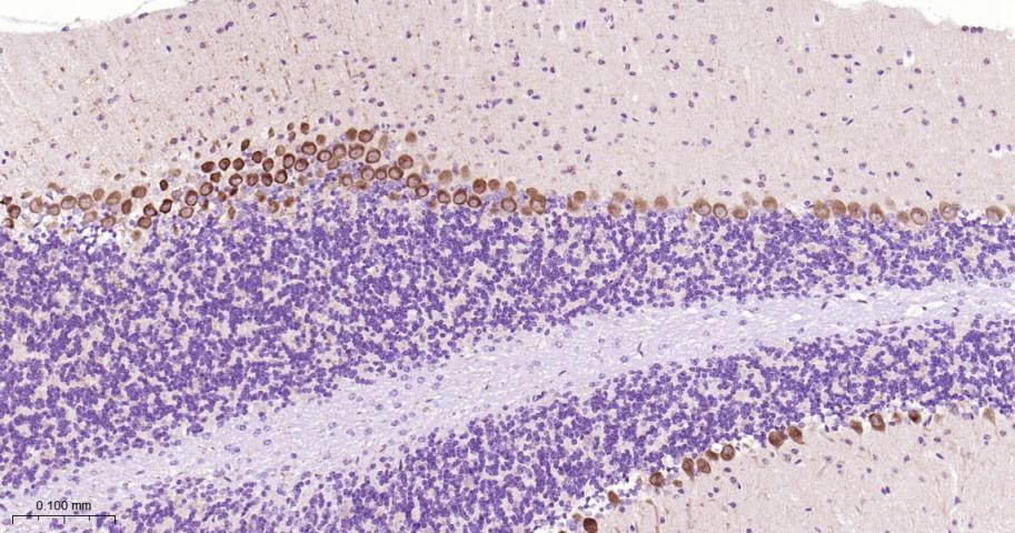 核糖体S6蛋白激酶重组兔单抗