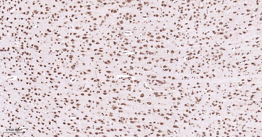 ALYREF重组兔单抗