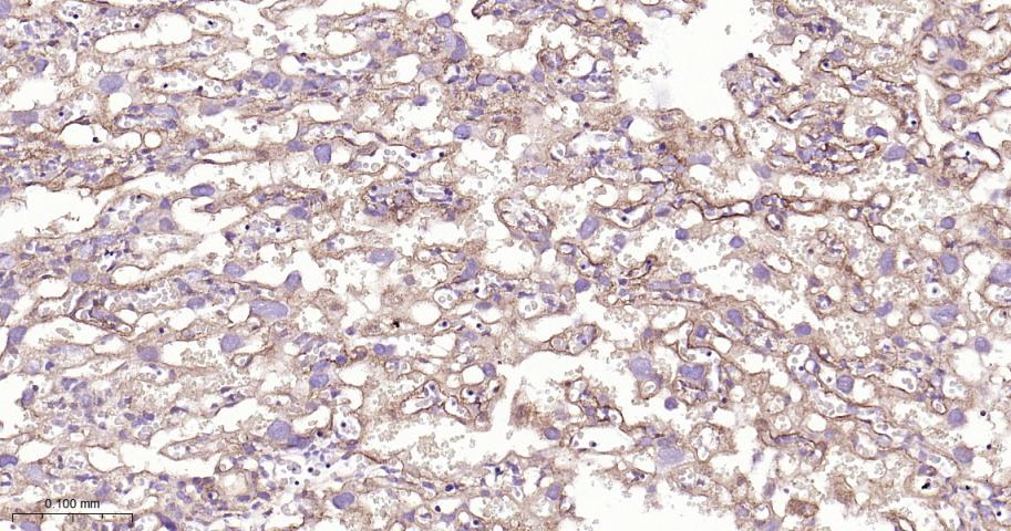 细胞膜钙ATP酶1重组兔单抗