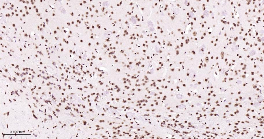 ALYREF重组兔单抗