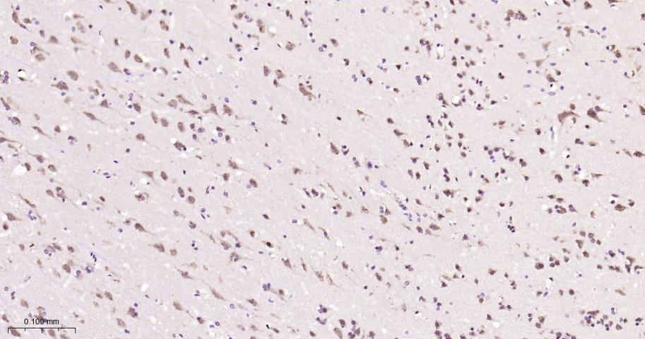 磷酸化干扰素诱导的双链RNA活化蛋白激酶重组兔单抗
