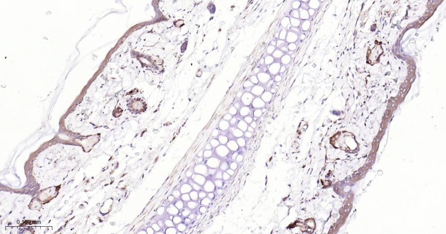 磷酸甘油酸脱氢酶单克隆抗体-bsm-60570M