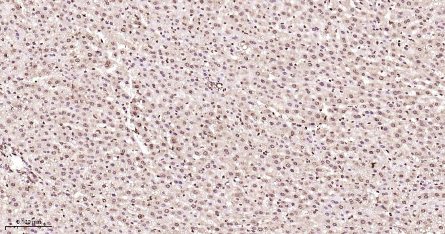 ALYREF重组兔单抗