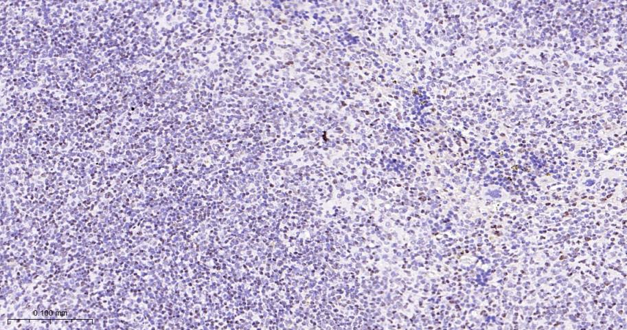 选择性剪接因子3B亚基1重组兔单抗