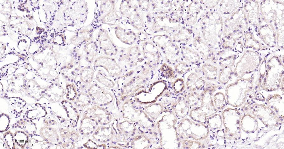 线粒体复合物NDUFS3蛋白重组兔单抗