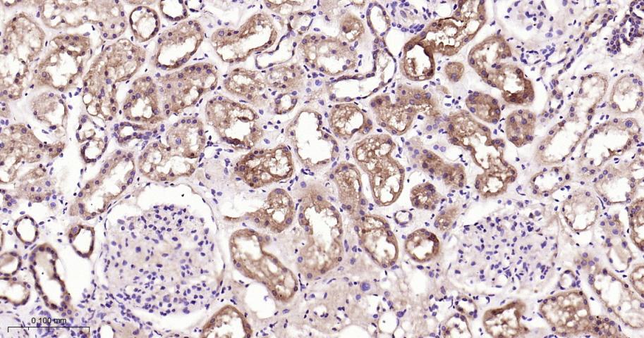 磷酸甘油酸脱氢酶单克隆抗体-bsm-60570M