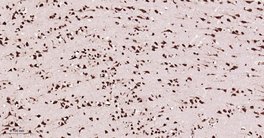 ALYREF重组兔单抗