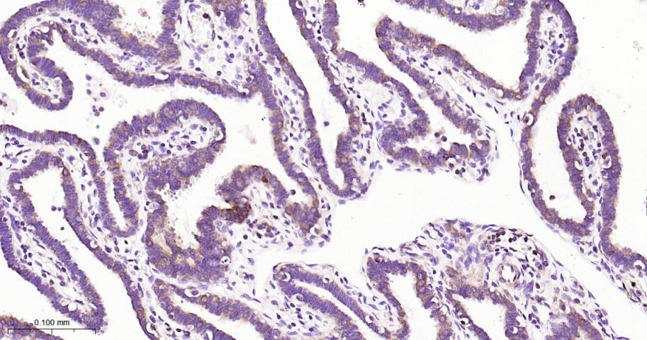磷酸甘油酸脱氢酶单克隆抗体-bsm-60570M