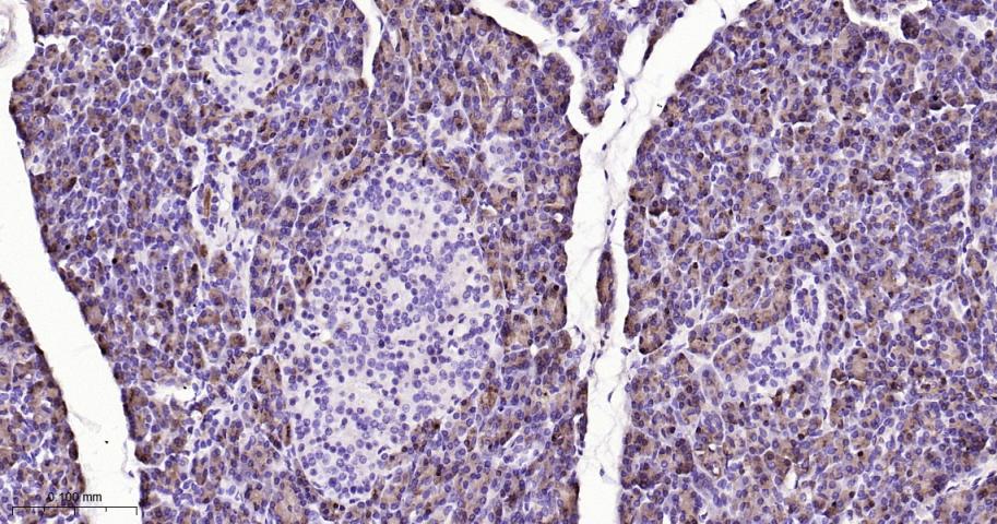 肿瘤相关胰蛋白酶抑制剂1重组兔单抗
