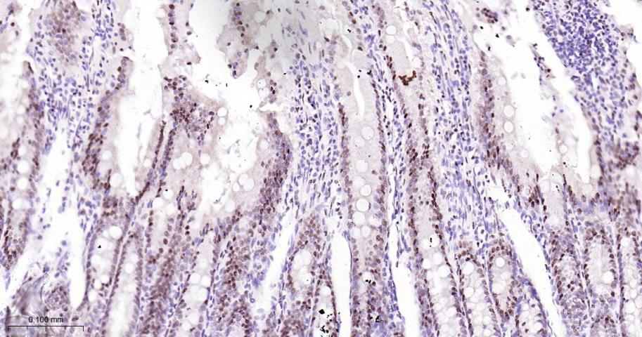 选择性剪接因子3B亚基1重组兔单抗