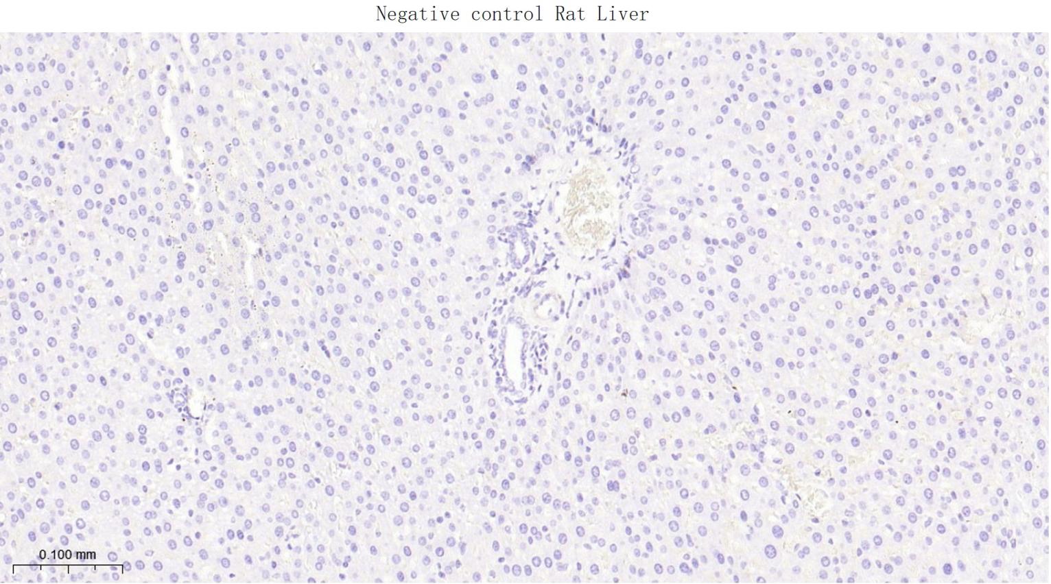 胞质紧密粘连蛋白1/闭锁小带蛋白1重组兔单抗
